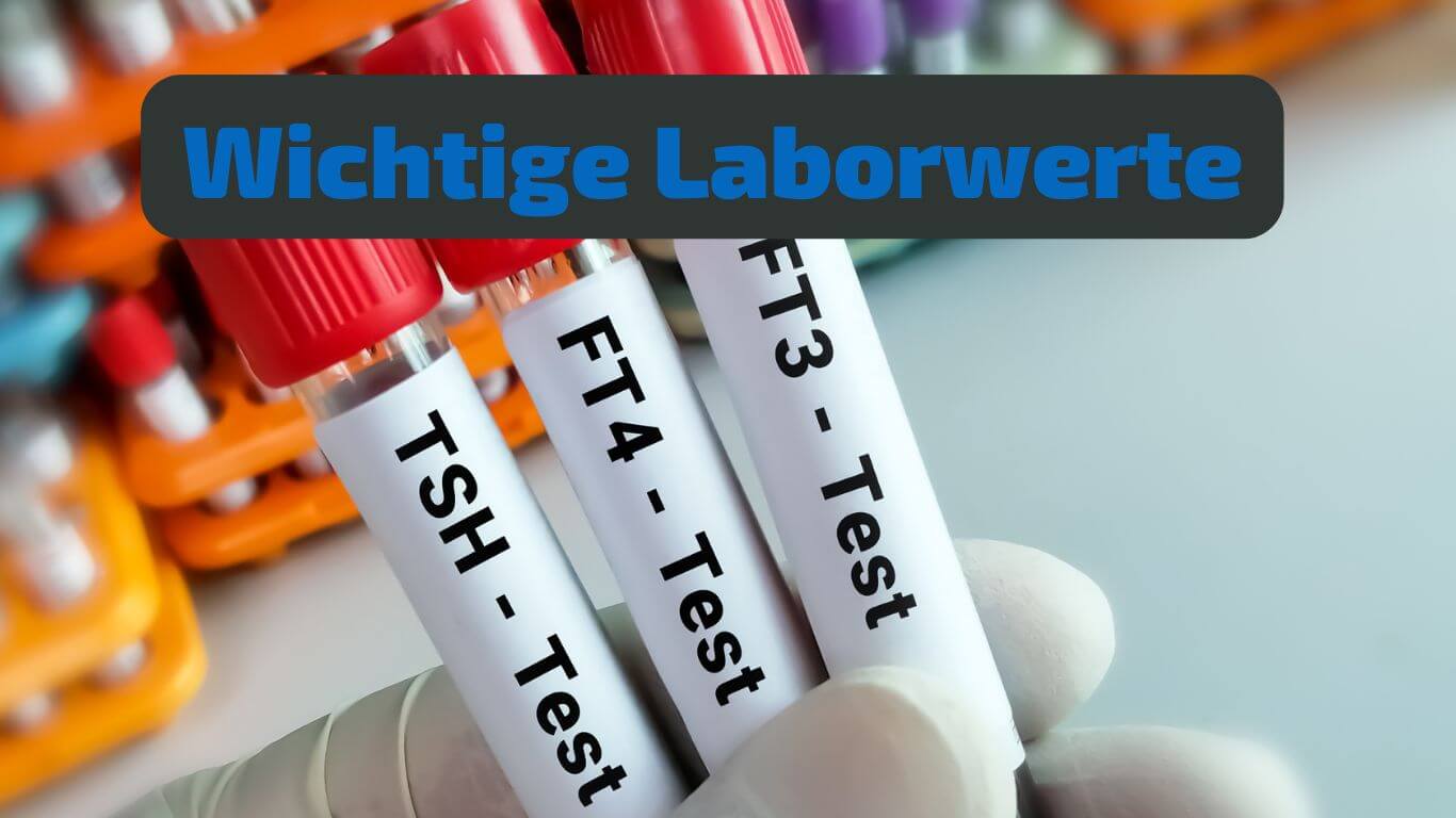 Schilddrüse Laborwerte